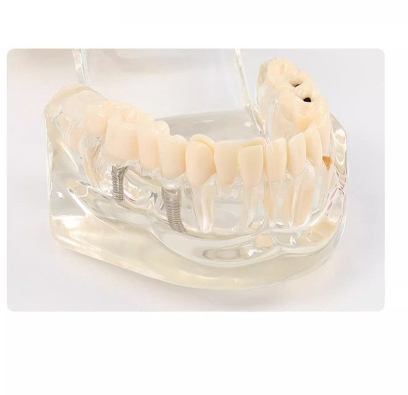 Dental model of teeth