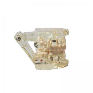 Dental model of teeth