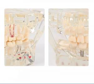 Dental model of teeth