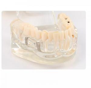 Dental model of teeth